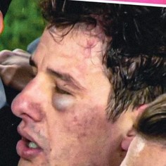 punched ref